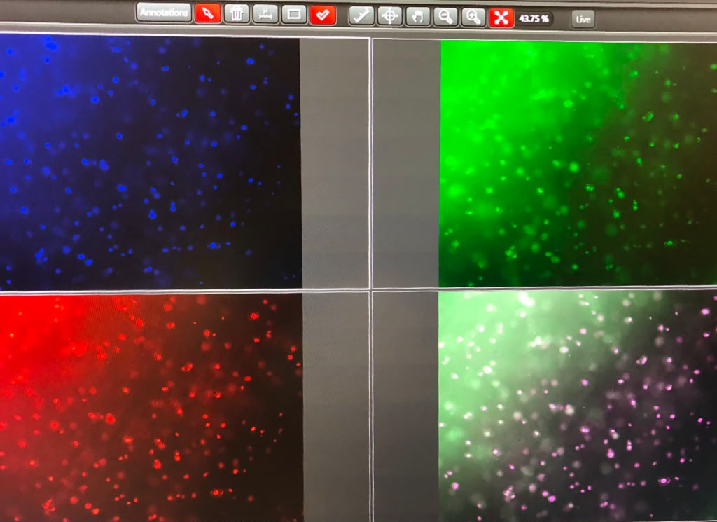 Cells under the microscope